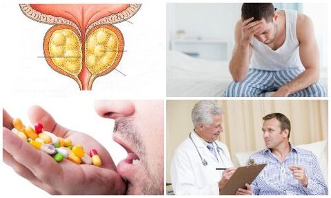 zapalenie prostaty u mężczyzn