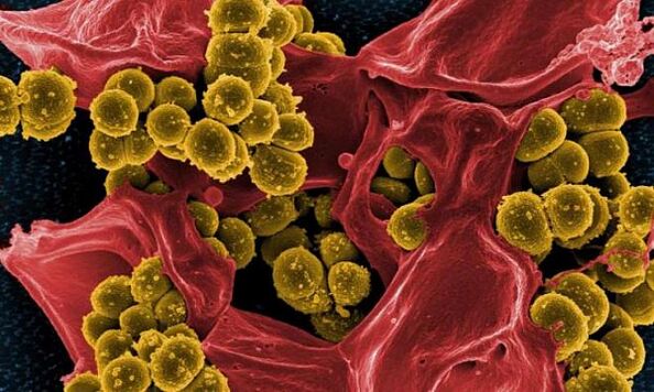 Staphylococcus aureus jako przyczyna bakteryjnego zapalenia gruczołu krokowego